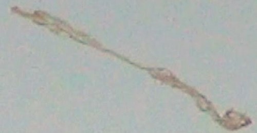 Strange Alien Substance Drops to Earth